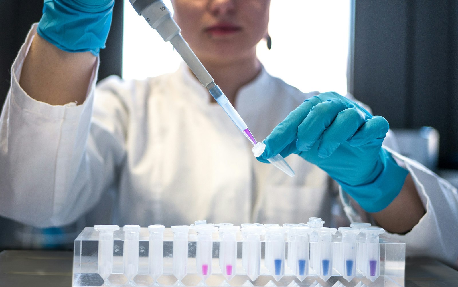 Euro Diagnostics Limited laboratory scientist at work